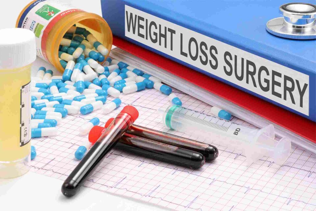 Gastric Sleeve Weight Loss Surgery: Everything You Need to Know