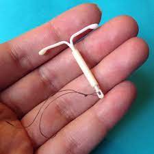 What is an IUD?
