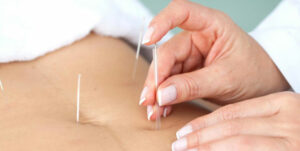 Will Acupuncture Help You Lose Weight?